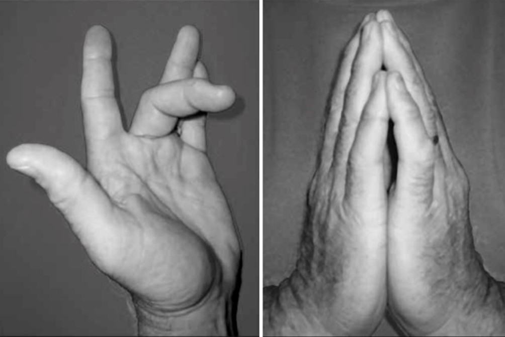 Signo de Oración y Dedo en Gatillo